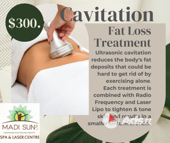 Cavitation Fat Loss Treatments